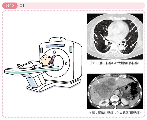 図13 CT