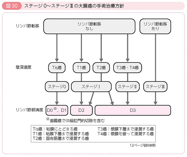 図30 ステージ0～ステージⅢの大腸癌の手術治療方針