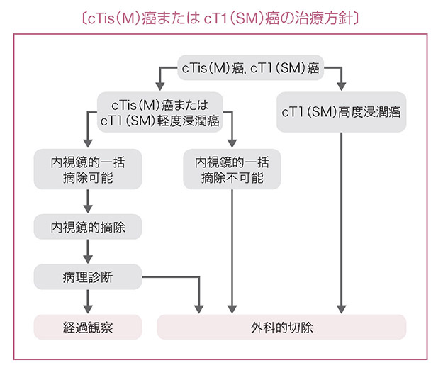 cTis（M）癌またはcT1（SM）癌の治療方針