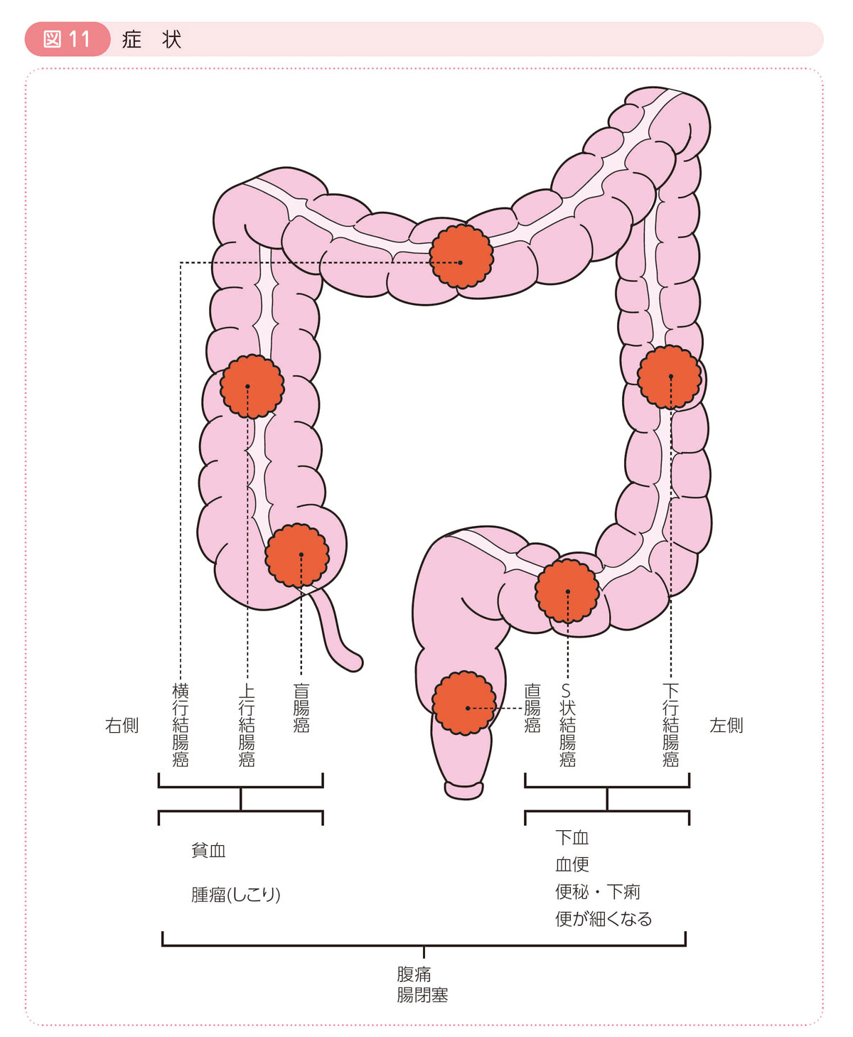 図11 症状