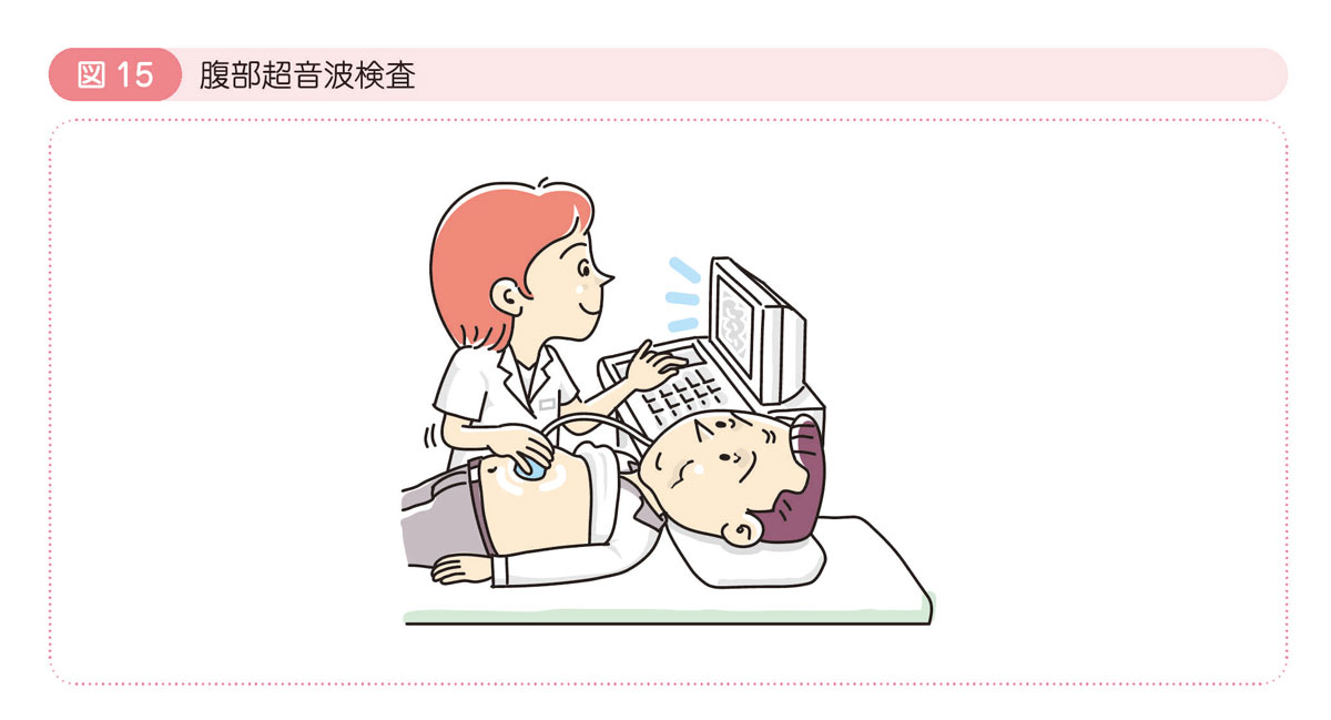 図15 腹部超音波検査