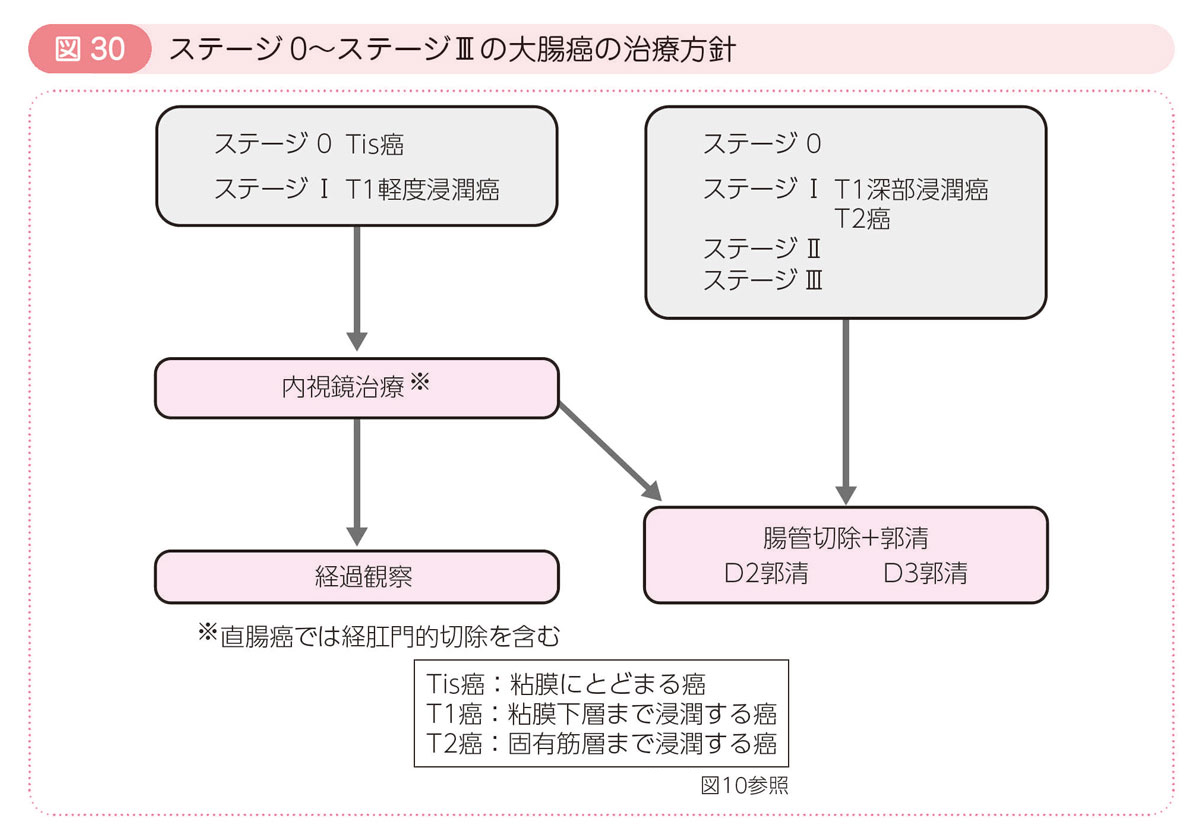 図30 ステージ0～ステージⅢの大腸癌の治療方針