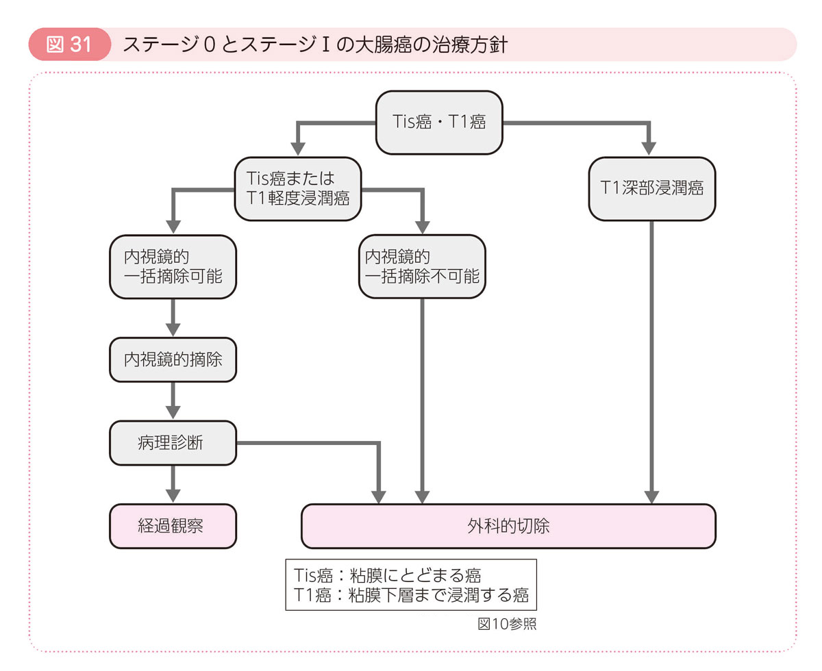 図31 ステージ0とステージⅠの大腸癌の治療方針