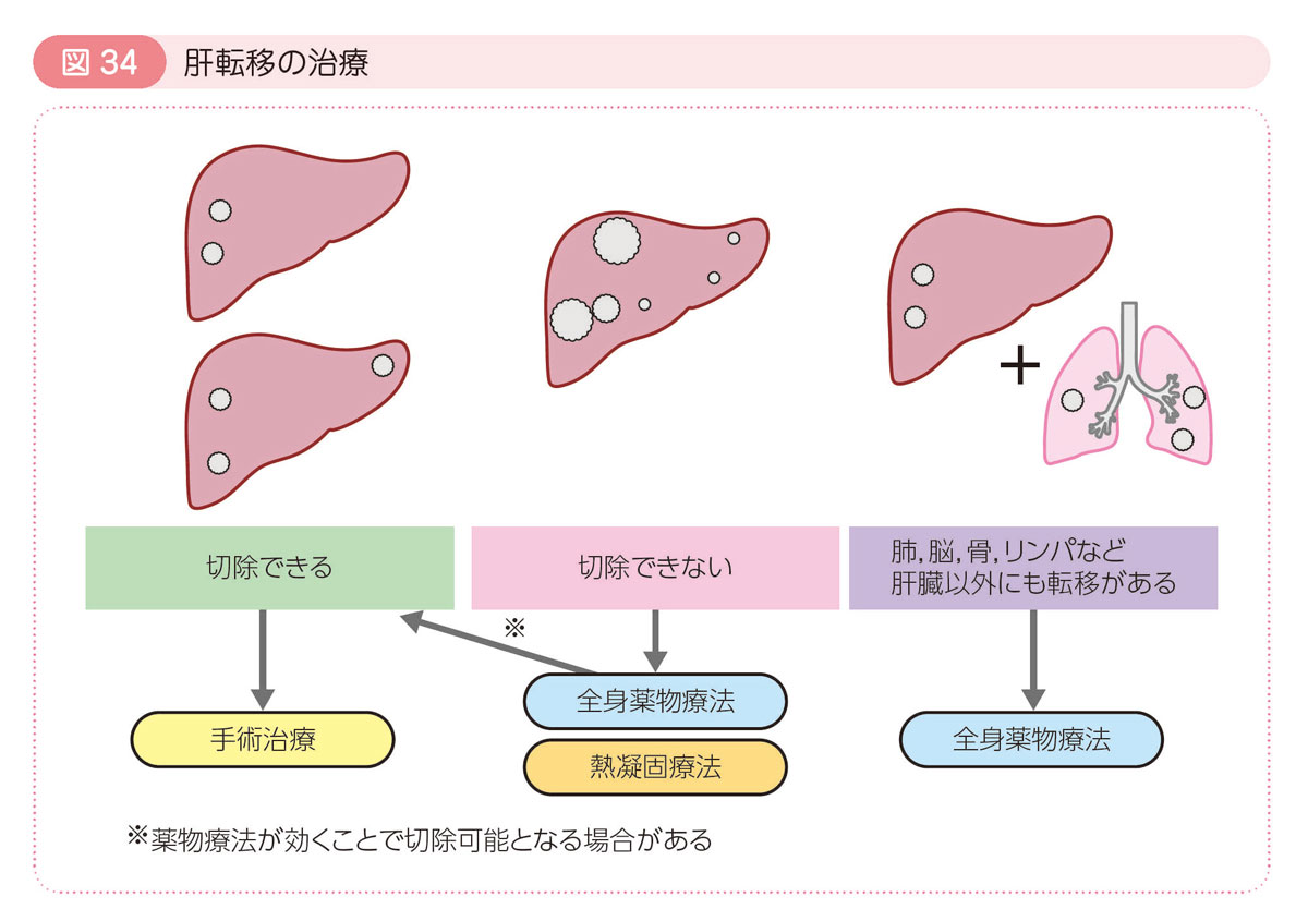 図34 肝転移の治療