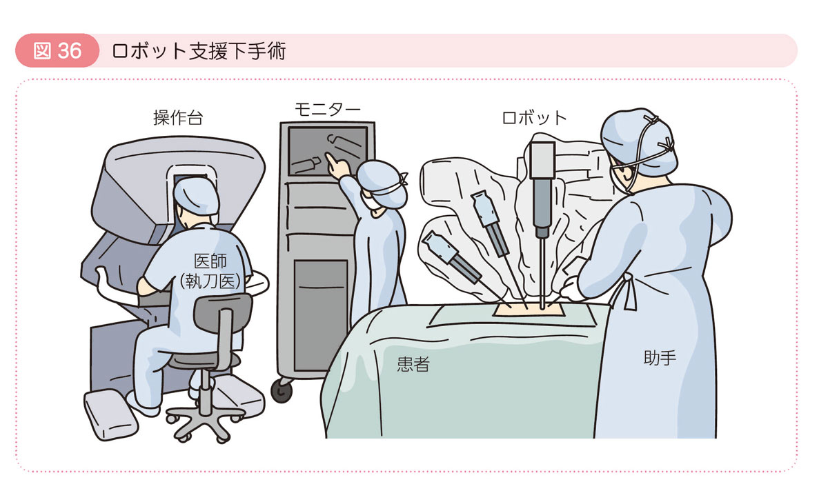 図36 ロボット支援下手術