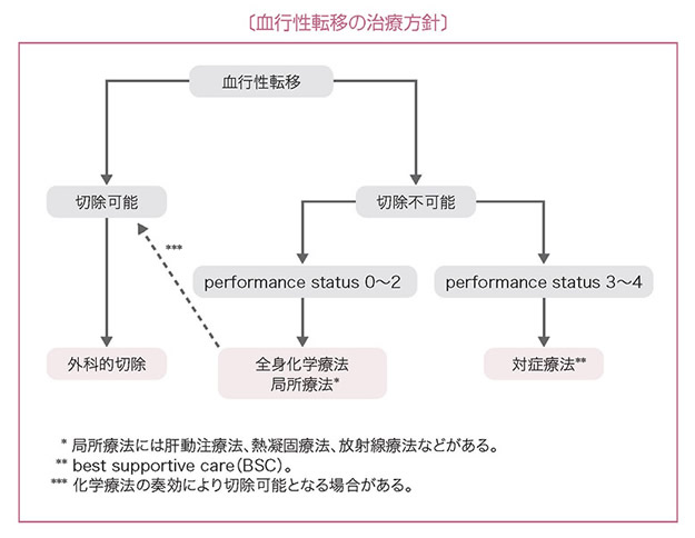 血行性転移の治療方針