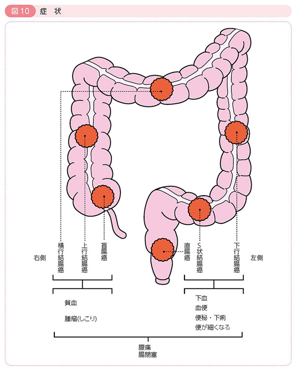 図10 症状