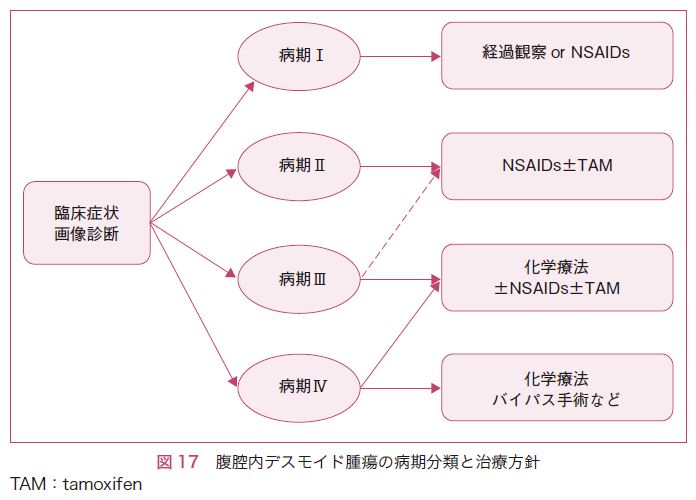 図17　腹腔内デスモイド腫瘍の病期分類と治療方針