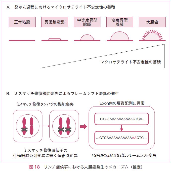 図18　リンチ症候群における大腸癌発生のメカニズム（推定）