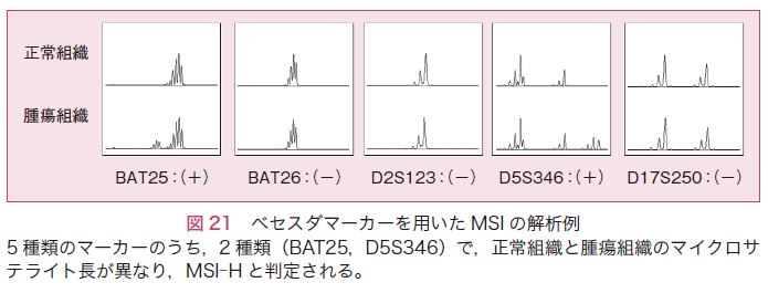 図21　ベセスダマーカーを用いたMSIの解析例