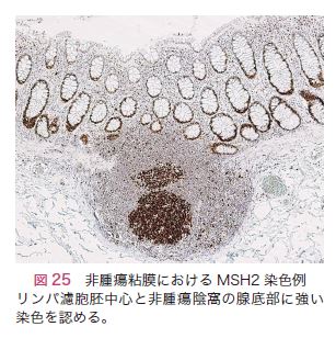 図25　非腫瘍粘膜における<i>MSH2</i>染色例