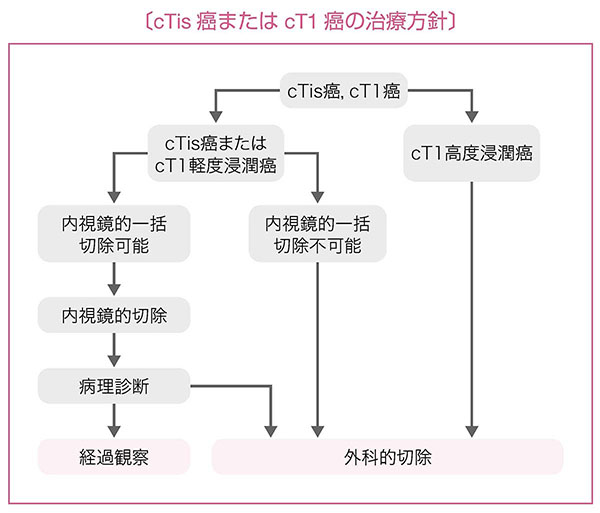 cTis（M）癌またはcT1（SM）癌の治療方針