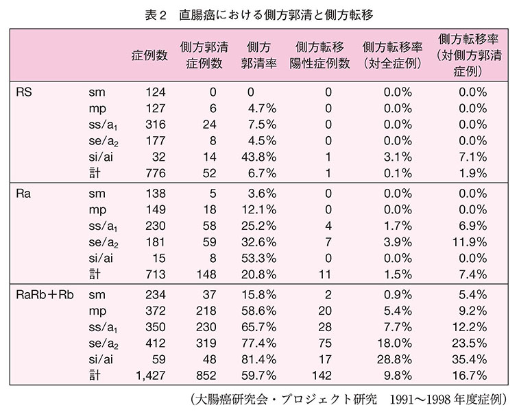 直腸癌における側方郭清と側方転移