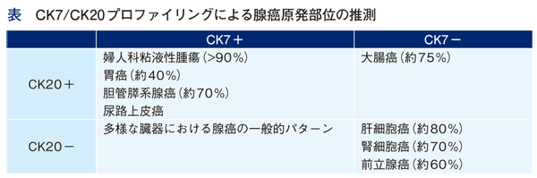 CK7/CK20プロファイリングによる腺癌原発部位の推測