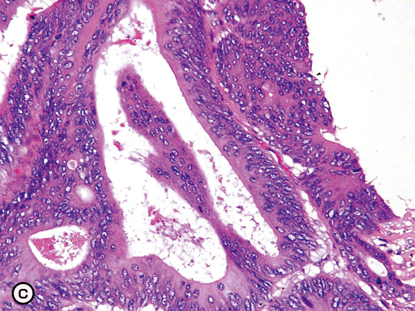 papillary rods